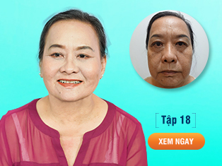 Tập 18: Cứu chữa đôi mắt thảm hoạ do thẩm mỹ sai cách cho U60