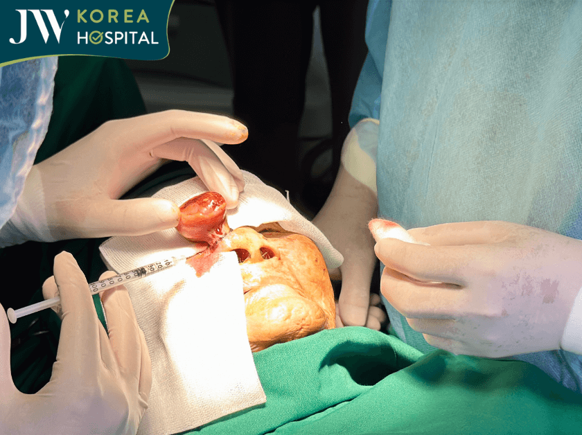 bác sĩ tú dung tiến hành phẫu thuật cắt khối u