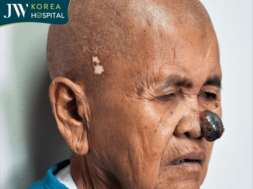 khối u ác tính của sư bà Khơ-me khi đến JW